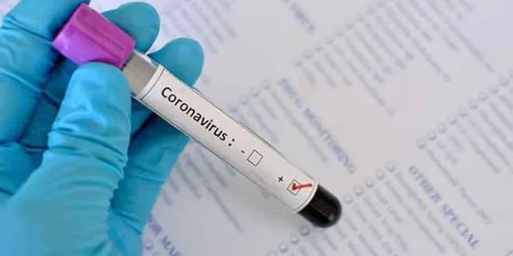 CORONA CASE UPDATE-लगातार बढ़ रहे हैं कोरोना के केस, 4 हजार सक्रिय केस,32 लोगों की मौत